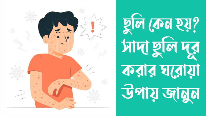 ছুলি কেন হয়